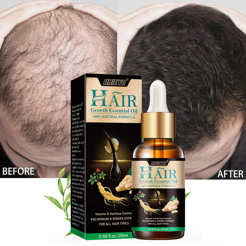 Licorice Root Sticks - 2023 Biotin Fast Hair Growth Oil