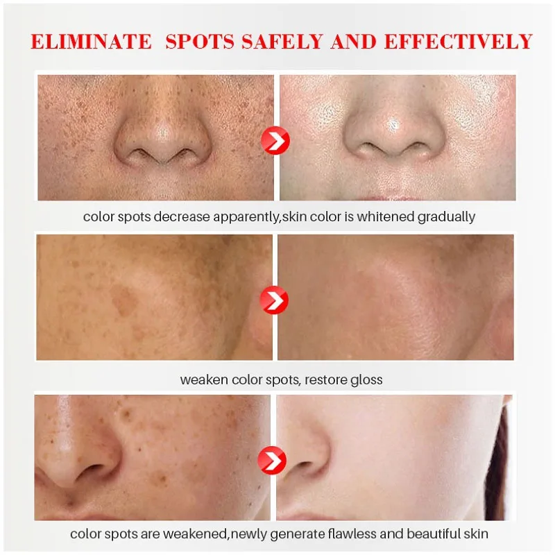 Effective Whitening Freckles C - đánh giá và giá Licorice Root Sticks