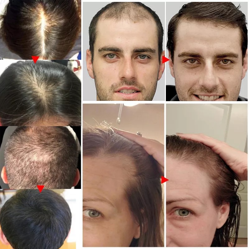 2023 Biotin Fast Hair Growth O - đánh giá và giá Licorice Root Sticks