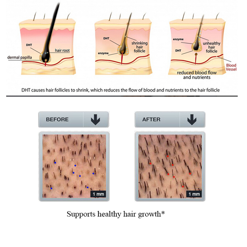 PURC 100ml Ginger Hair Loss Sh - đánh giá và giá Licorice Root Sticks